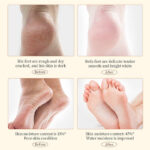SADOER Anti-Cracking Hand & Foot Cream 60g - Image 3