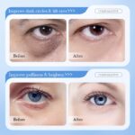 SADOER Hyaluronic Acid Anti-aging Repair Six-piece Set  100g+100ml+100ml+30ml+30g+20g - Image 6