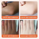 SADOER Joint Whitening and Dark Spot Removal Essence 50ml - Image 2